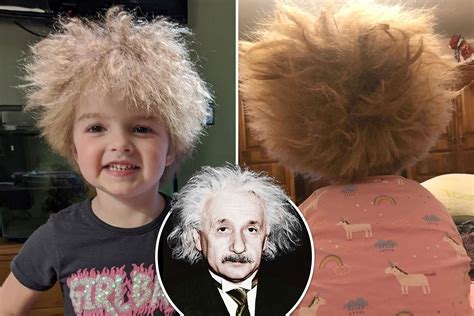 albert einstein syndrome|Iba pa.
